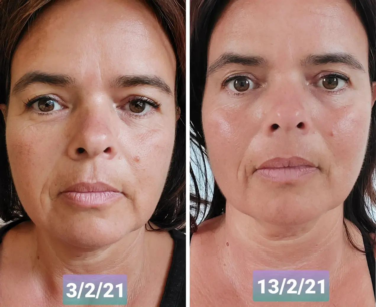 happy face yoga before and after - Does happy face yoga work