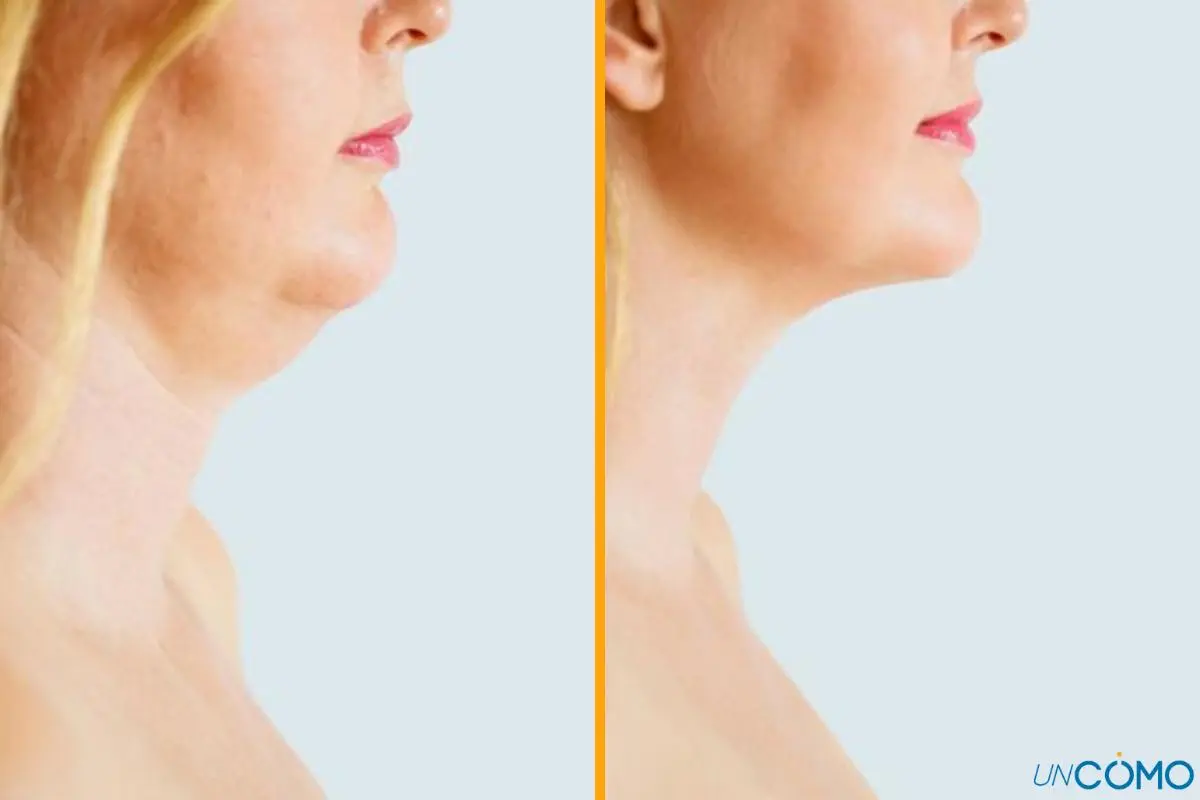 yoga facial cachetes - Qué hacer para bajar los cachetes de la cara